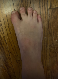 Top 5 Ugly Feet OnlyFans Accounts to Follow fanscribers