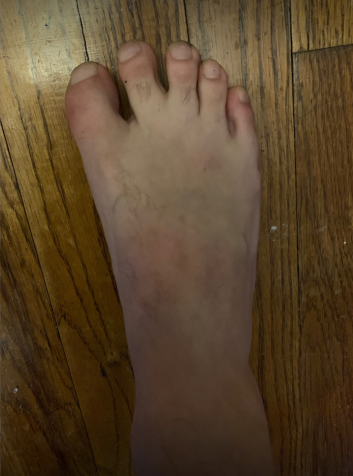 Ugly foot of onlyfans creator AmericanFeet1776