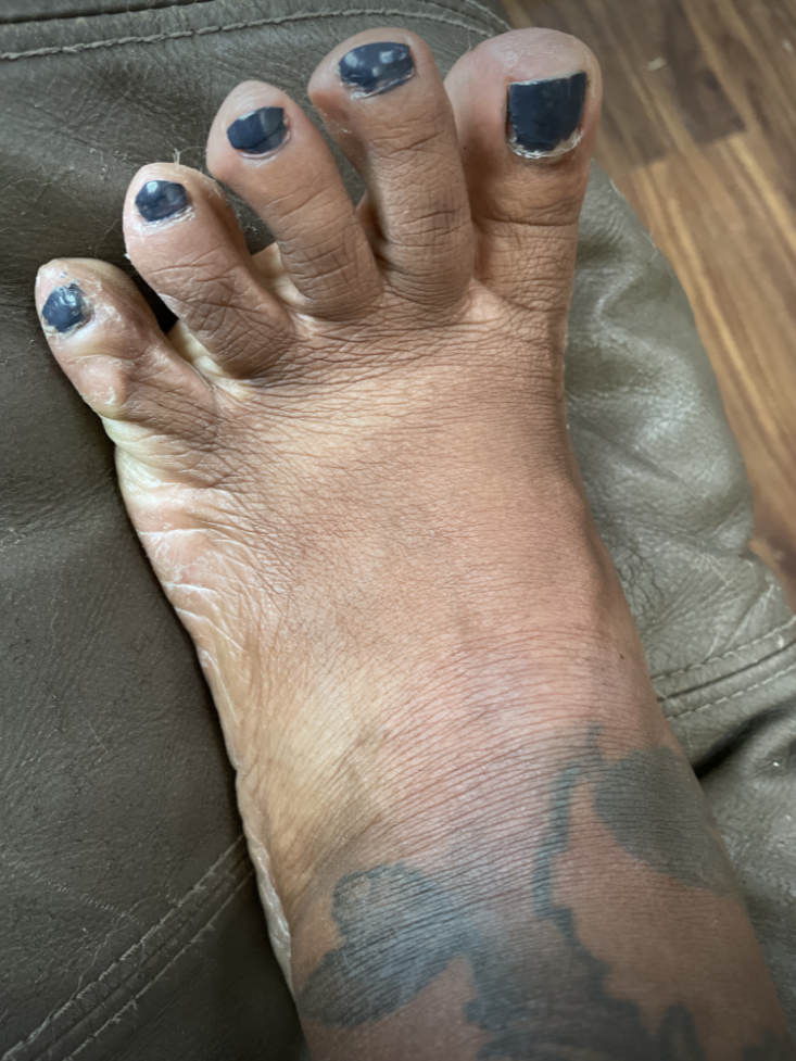 Ugly foot of onlyfans creator Ugly feet.